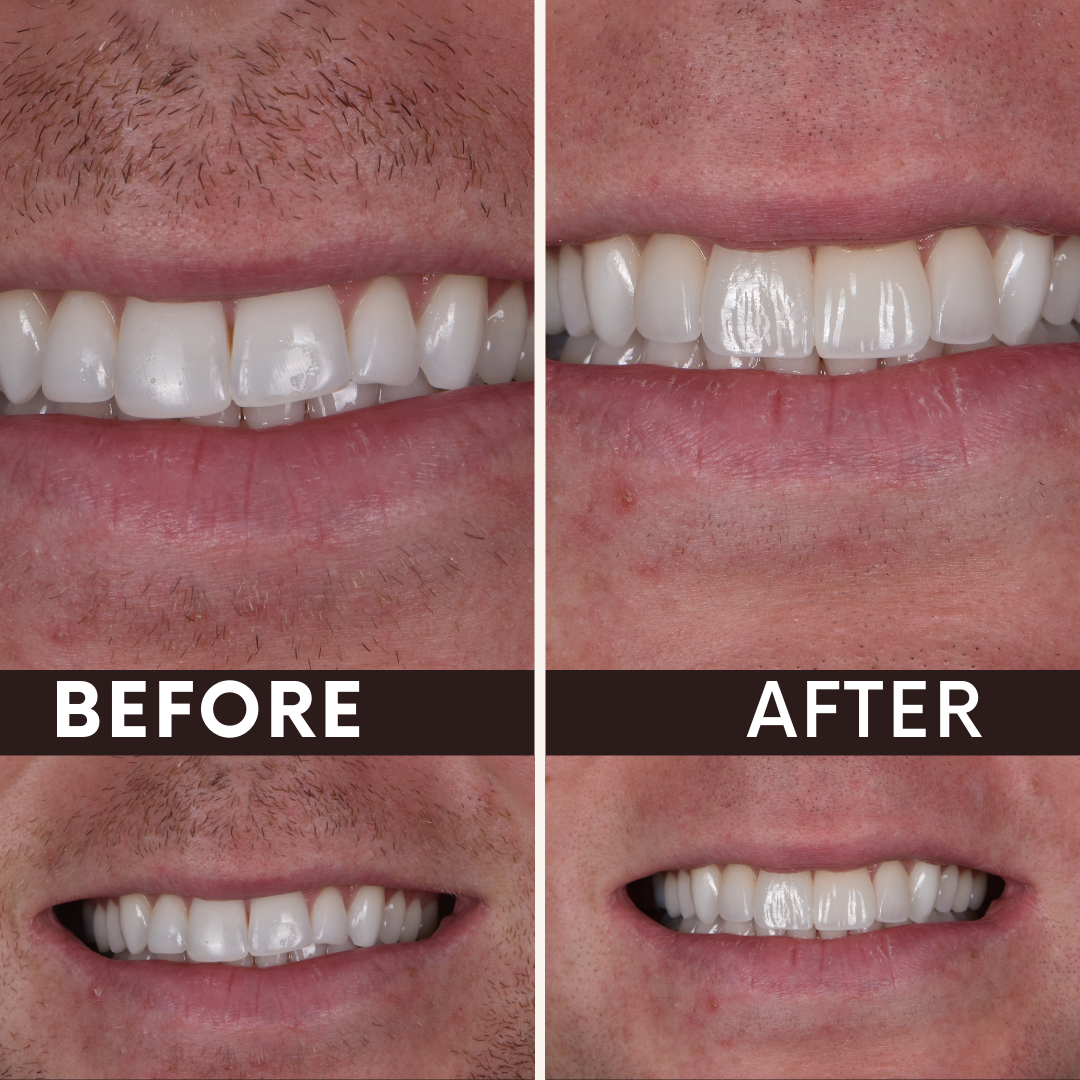 Smile transformation