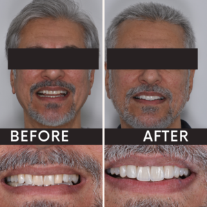 Before after minimal skincare Instagram post