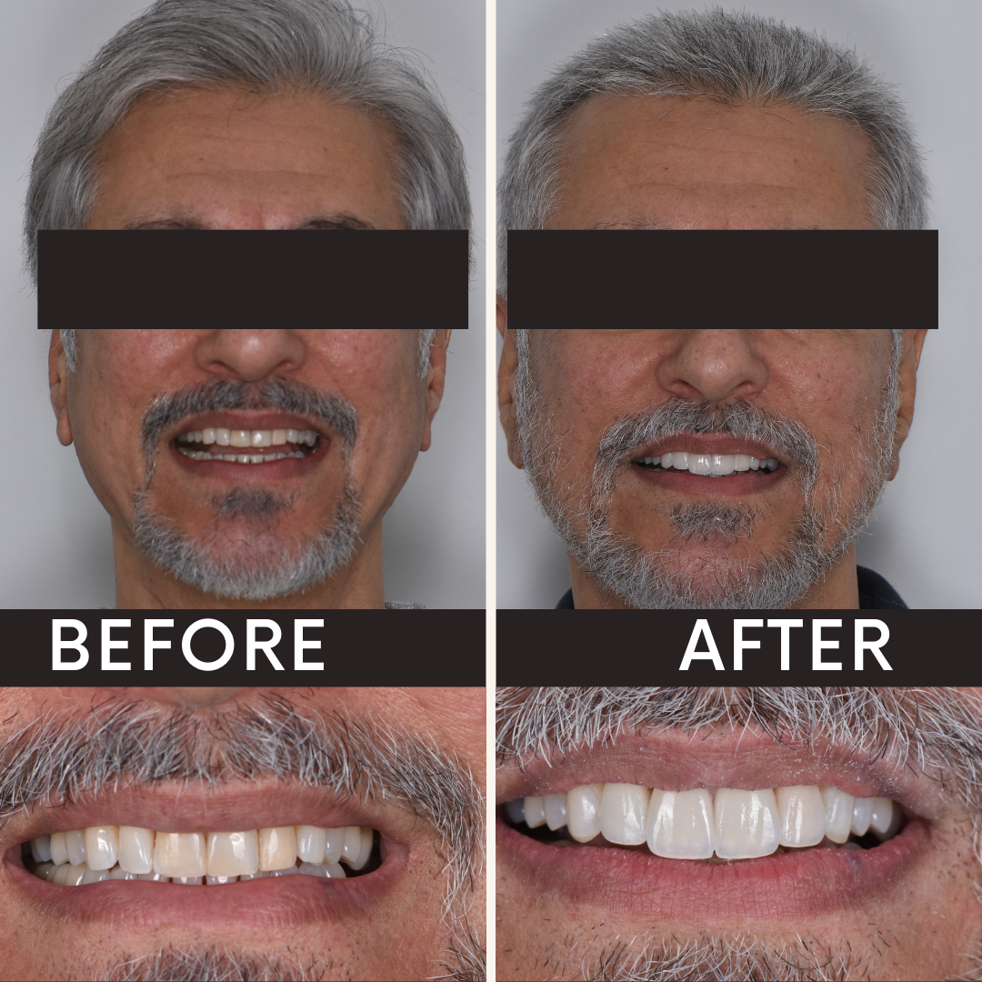 Before after minimal skincare Instagram post